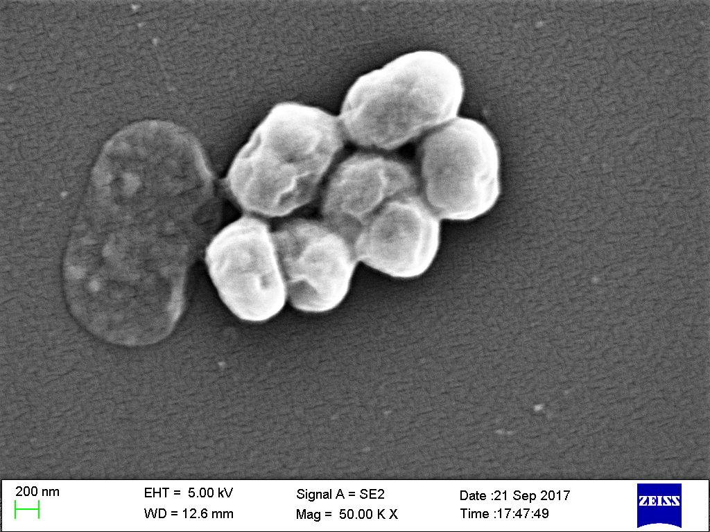 Acinetobacter baumannii